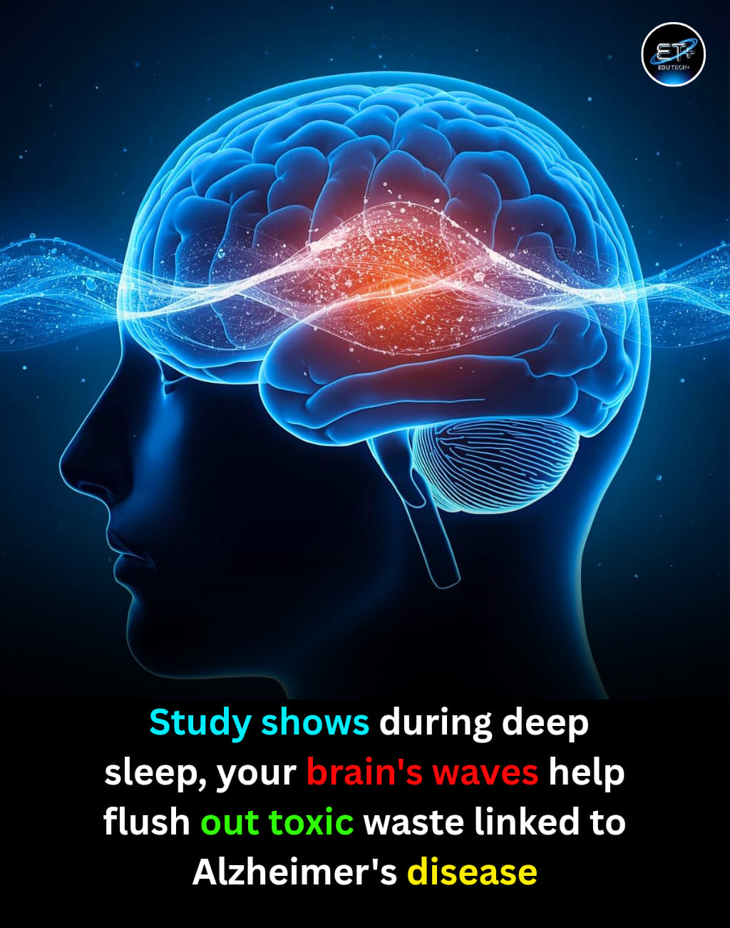 Deep sleep helps brain remove toxins linked to Alzheimer's