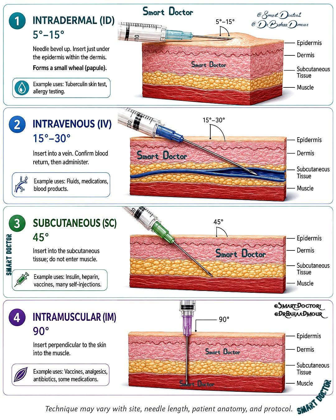 b12 injection subcutaneous vs intramuscular Difference Between Intravenous Pharmacist Neeraj Bharti Innovator Pharmacy Innovator Academy Revitalizing Energy and Cognition: weight loss & sports nutrition Pack Size:1 ml x 10 Injections