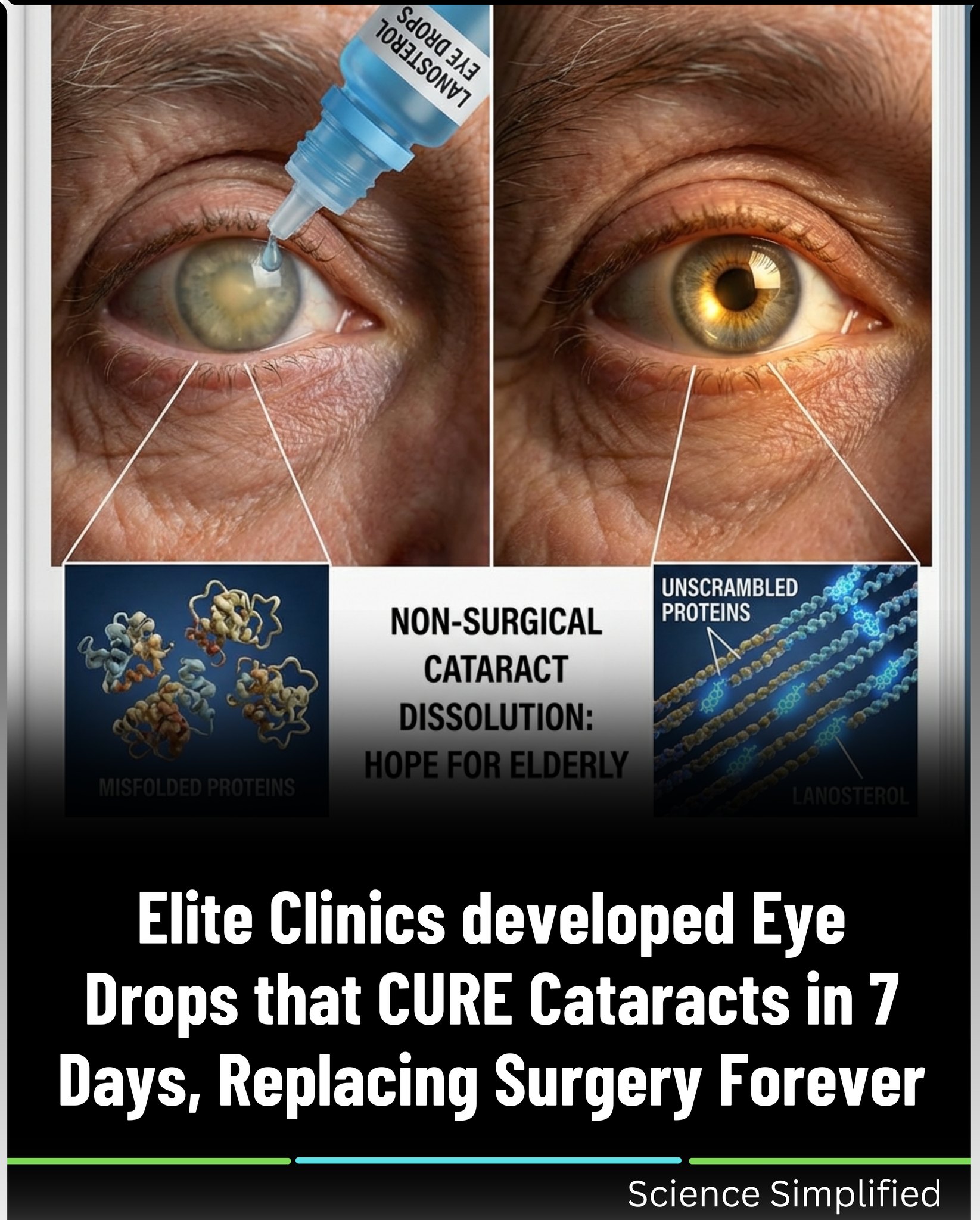 dmso cataracts glutathione vitamin c Lanosterol eye drops for canine nutritional-supplement