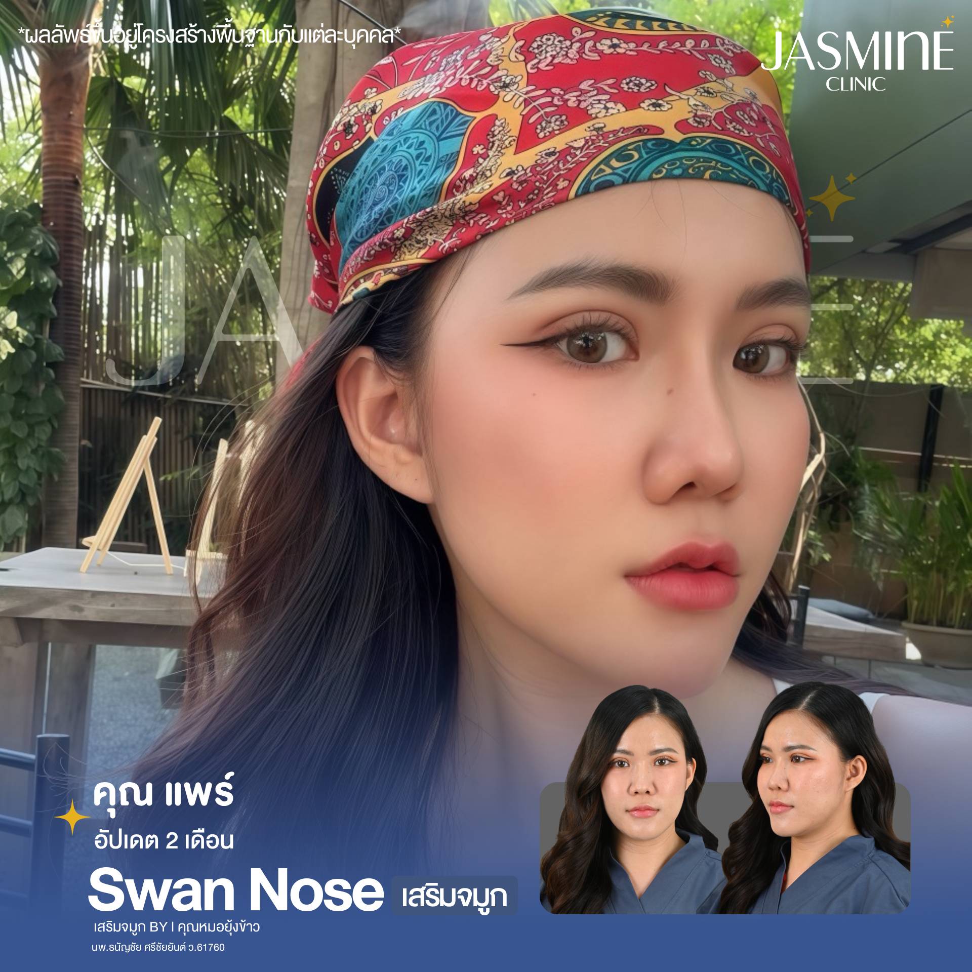 Jasmine Clinic จัสมินคลินิก เชียงราย ศัลยกรรม เสริมจมูก ตาสองชั้น ...