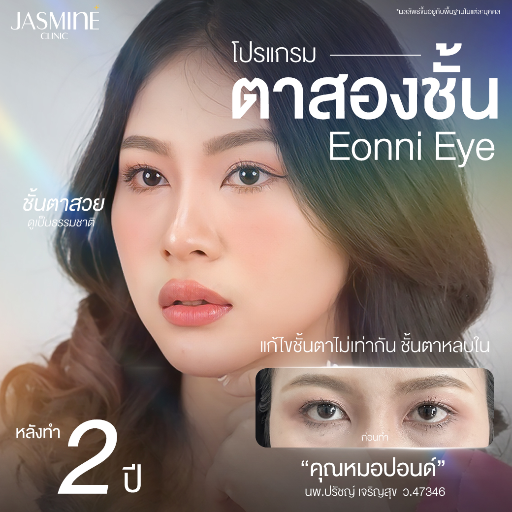 Jasmine Clinic จัสมินคลินิก เชียงราย ศัลยกรรม เสริมจมูก ตาสองชั้น ...