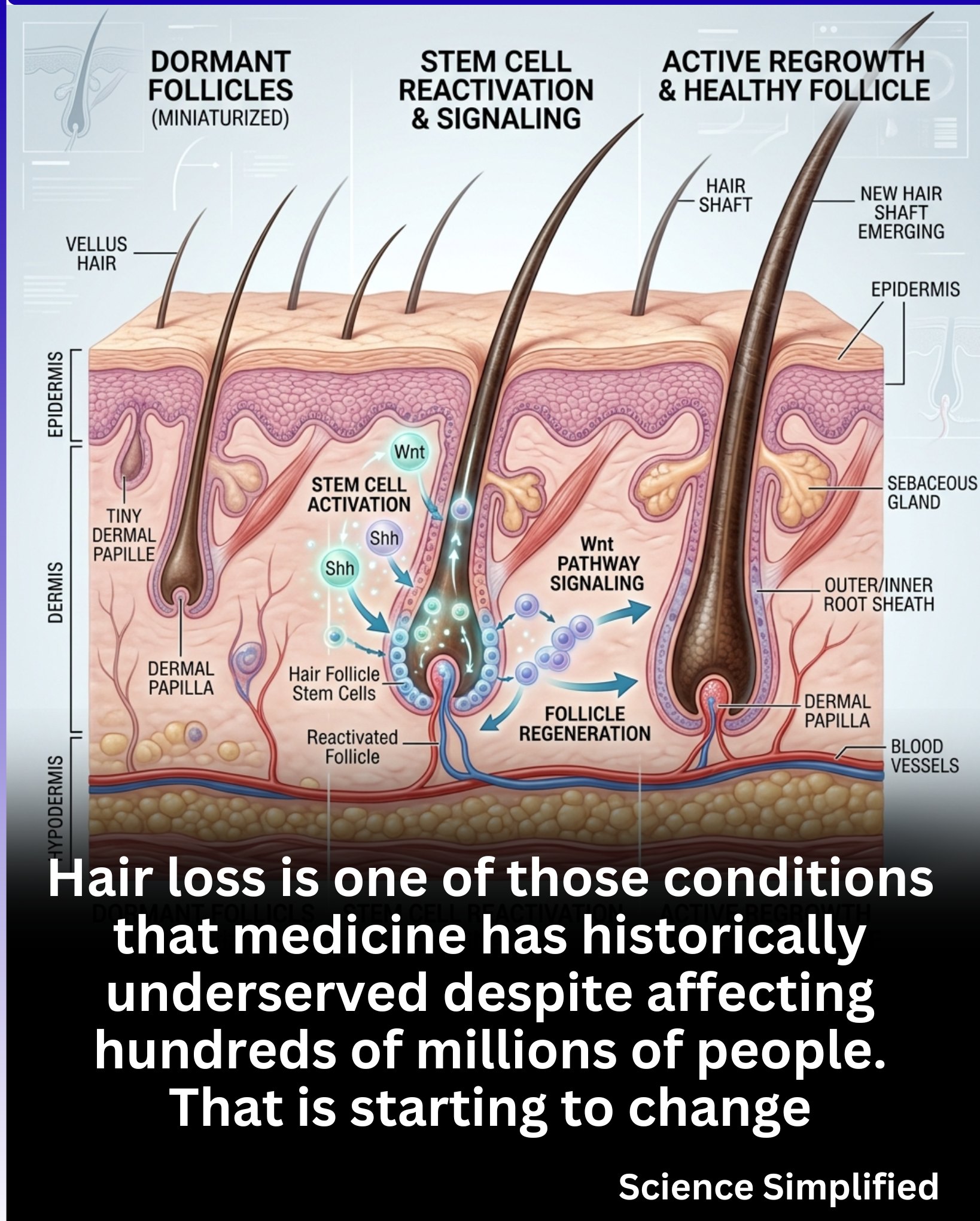 ghk-cu hair growth study dermal papilla injections for loss are trending hard online right now but wheres the actual evidence?, In this video I GHK-Cu peptide for hair: the