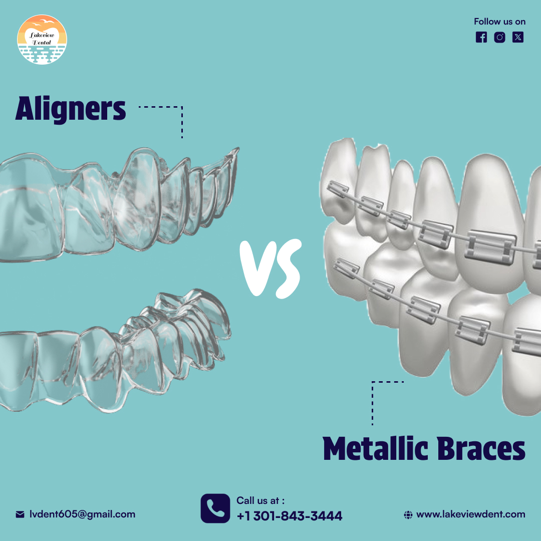 Lakeview - Aligners vs. Metal Braces: Which is Better for Your Smile ...