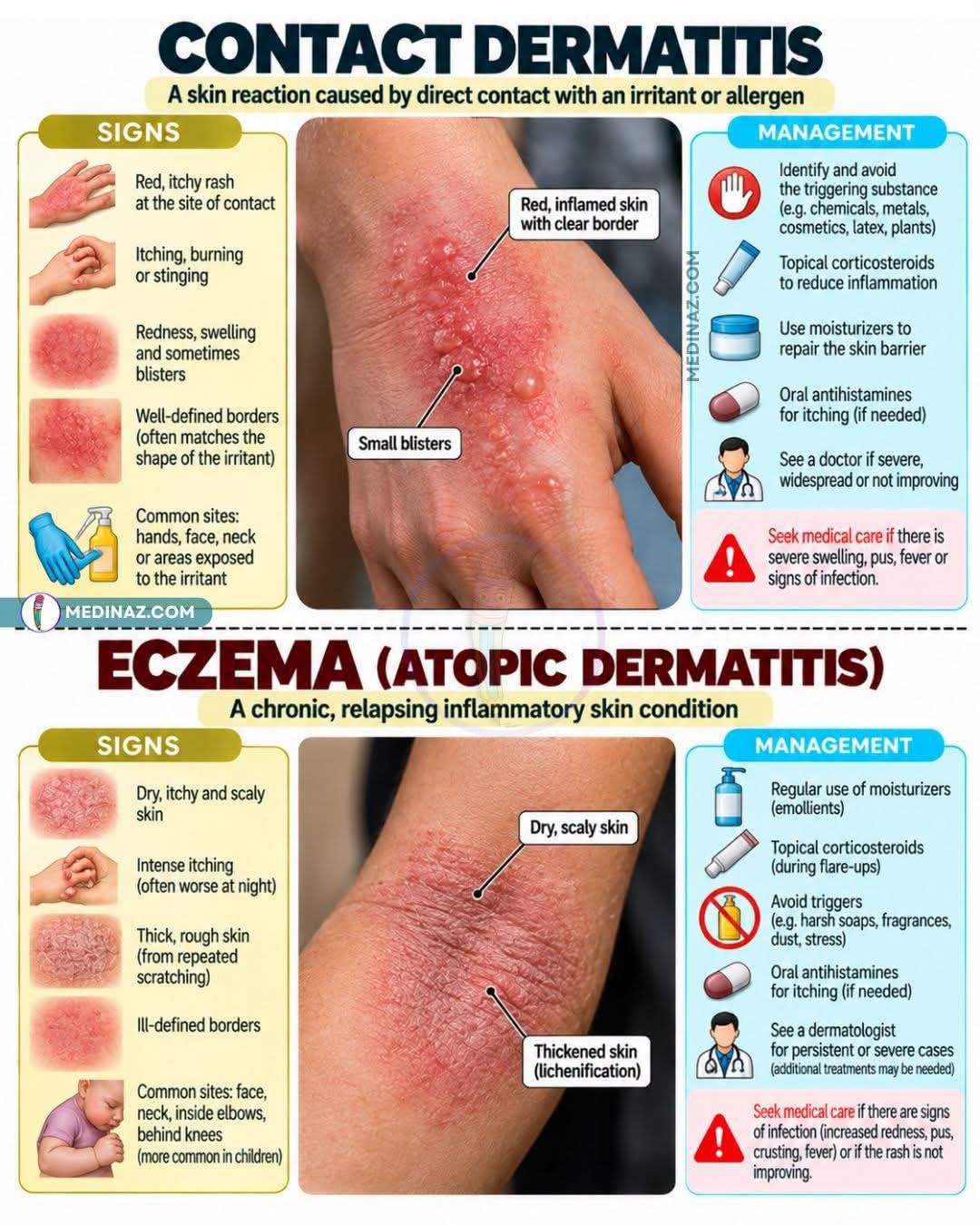 ghk-cu eczema or atopic dermatitis Contact vs Eczema: Key Differences and Symptoms Iron Drip