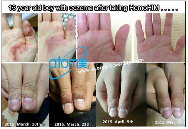 Hemohim Testimonies Updated April 28 2018