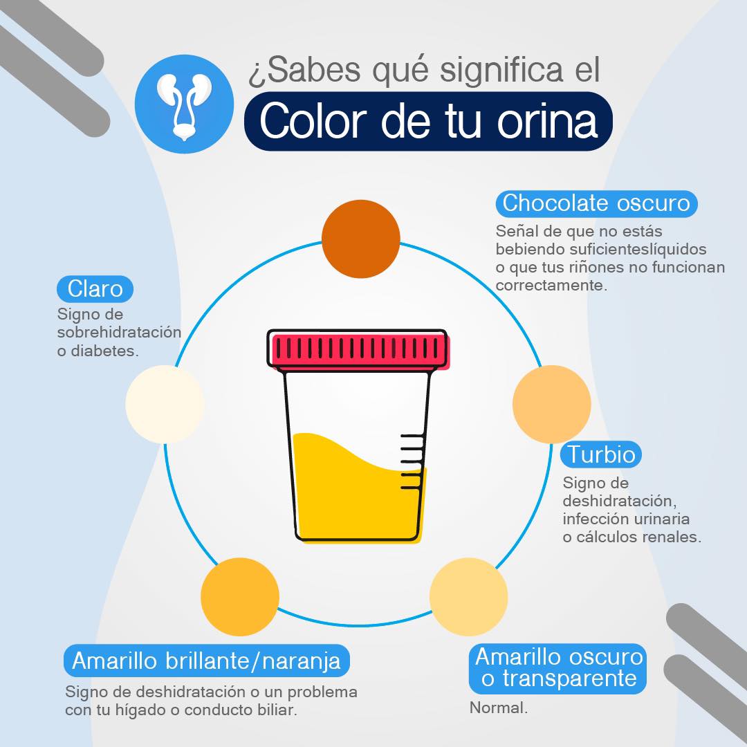 El color de tu orina puede decir... - Urólogos Asociados | Facebook