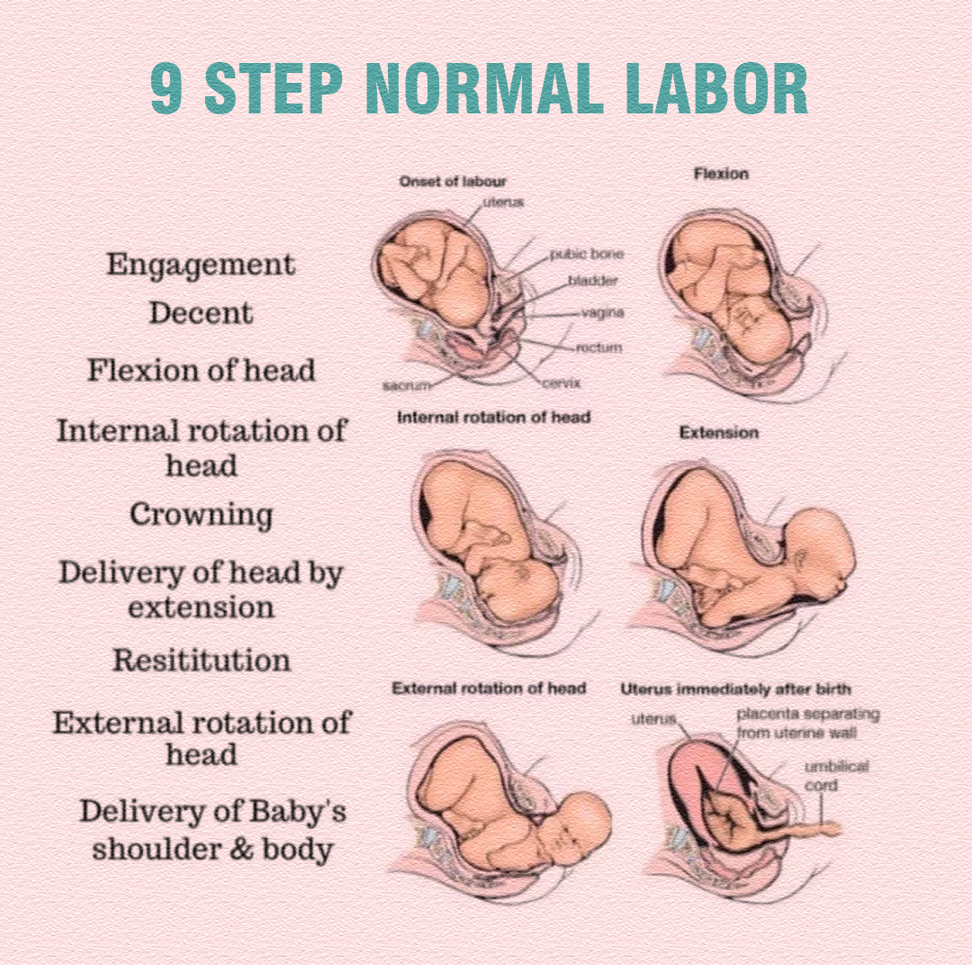 🤰🔥 WHAT LABOR FEELS LIKE? 🔥🤰 ⚡... - Pregnancy & Parenting | Facebook