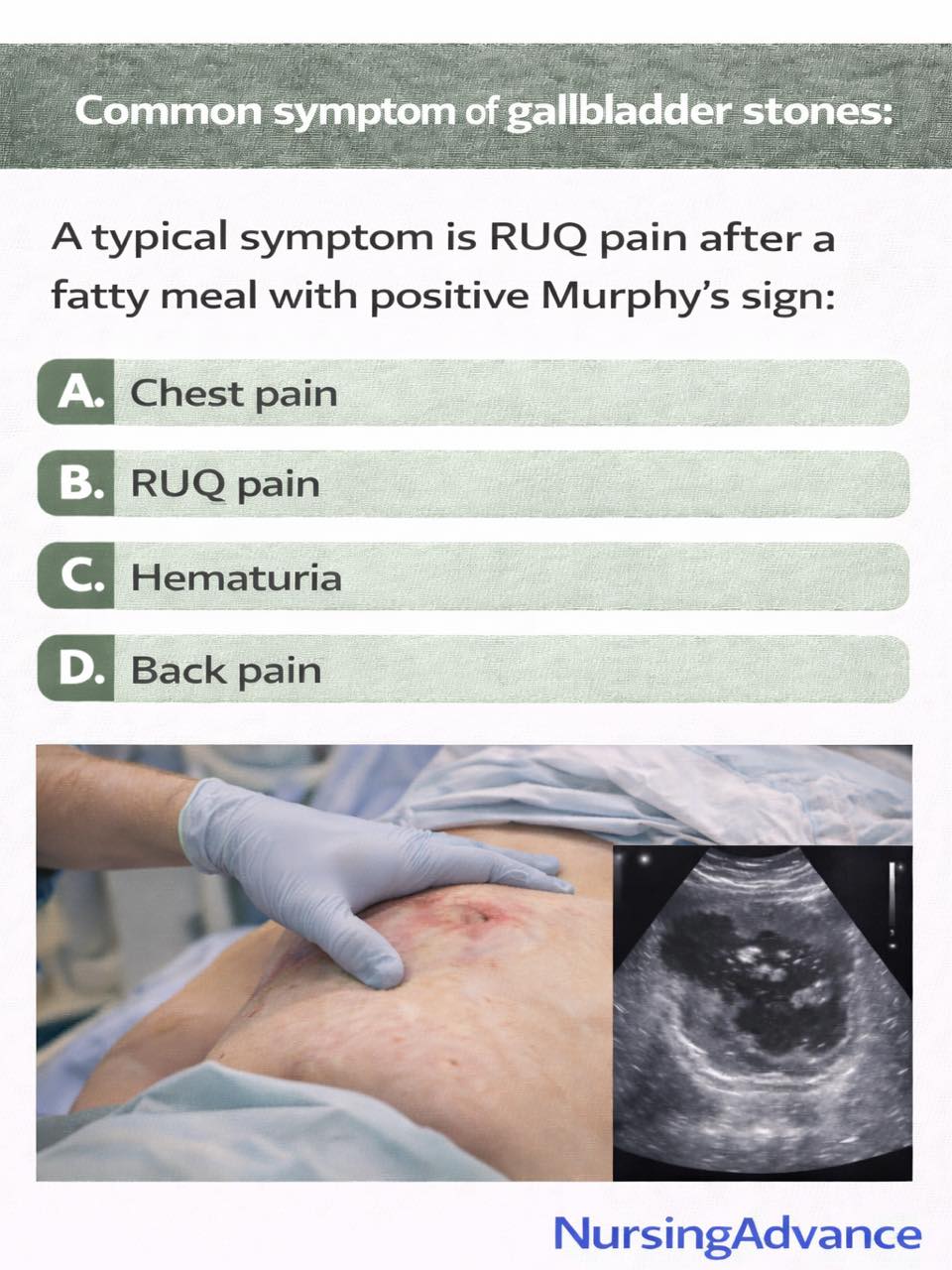 Nursing - Q2345.Common symptom of gallbladder stones: A typical symptom ...