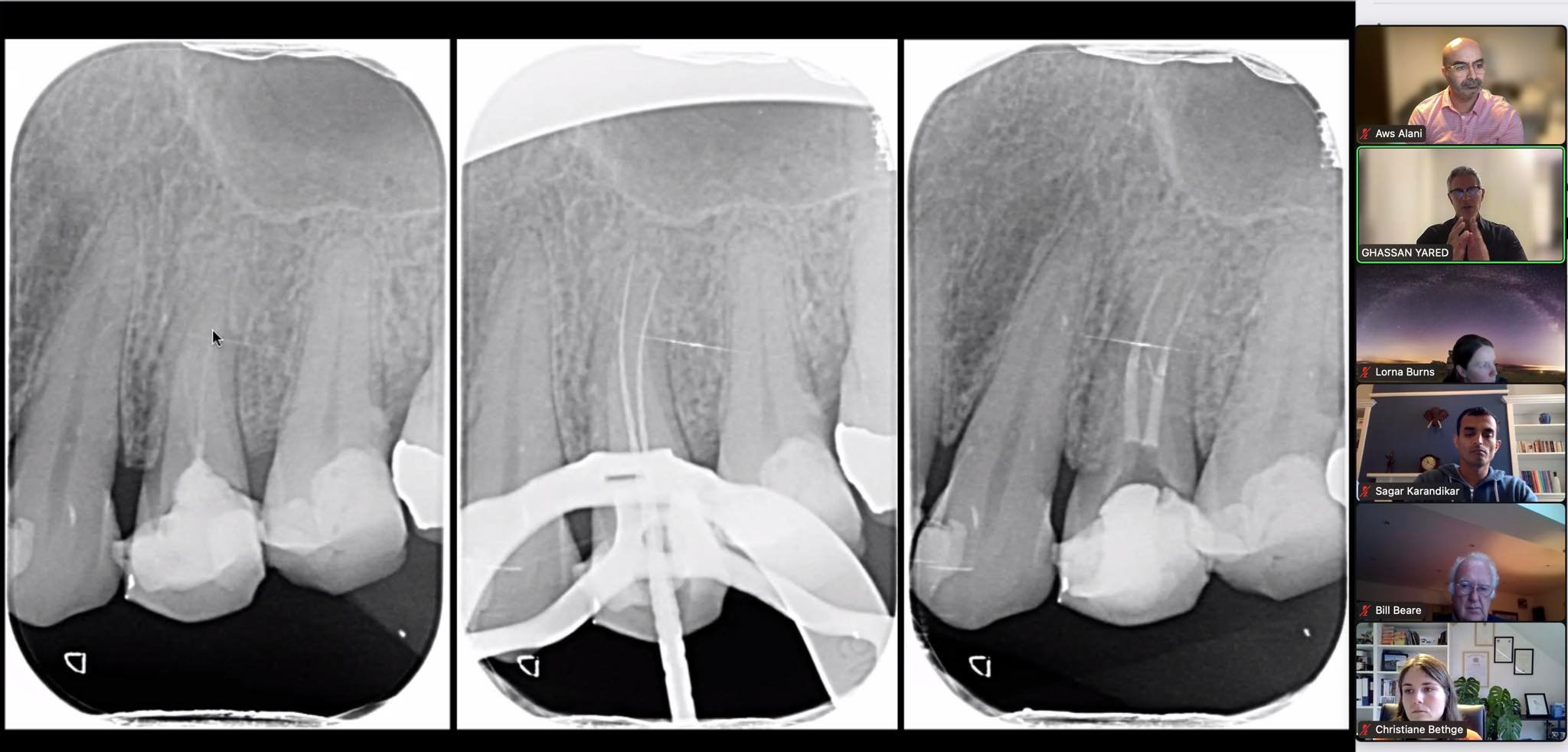 Key Topics in Restorative Dentistry