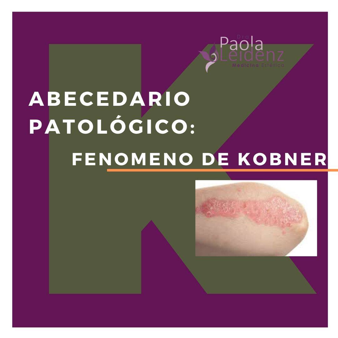 Dra. Paola Leidenz - El fenómeno de Koebner o Fenómeno isomórfico de ...