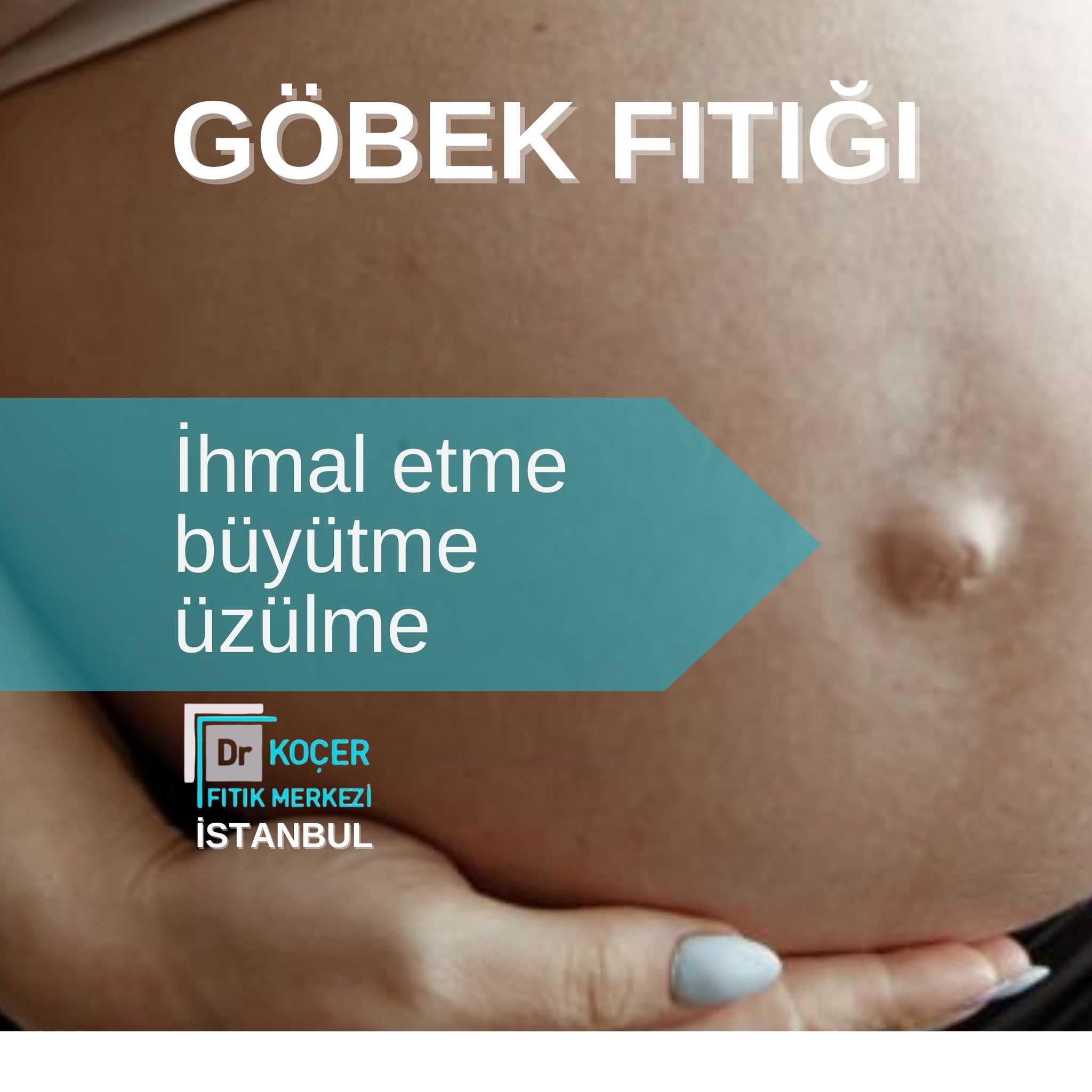 İstanbulda - Göbek fıtıkları ihmal edilmemesi gereken sağlık ...
