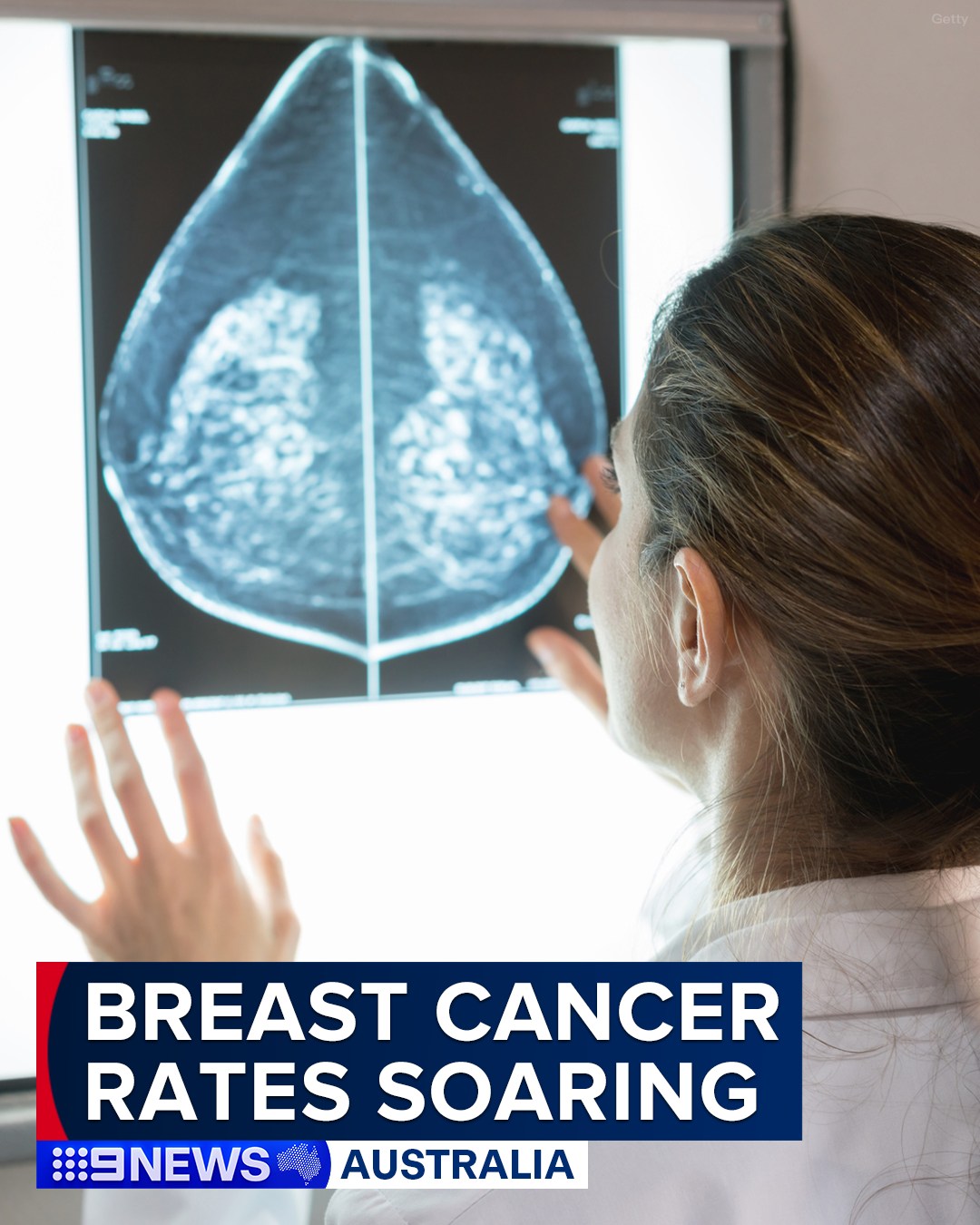 9 News - Breast cancer numbers in young women are soaring, with more ...