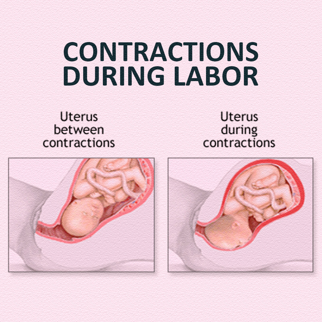 Pregnancy - CONTRACTIONS DURING LABOR: HOW IT FEELS 🤰🔥 Real, intense ...