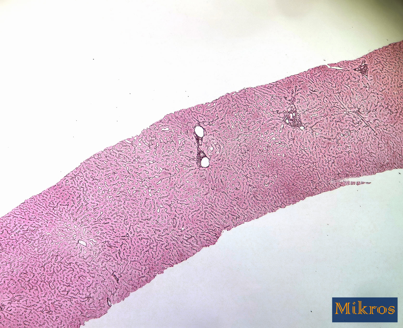 Mikkros - • Liver normal reticulin staining outlining... | Facebook