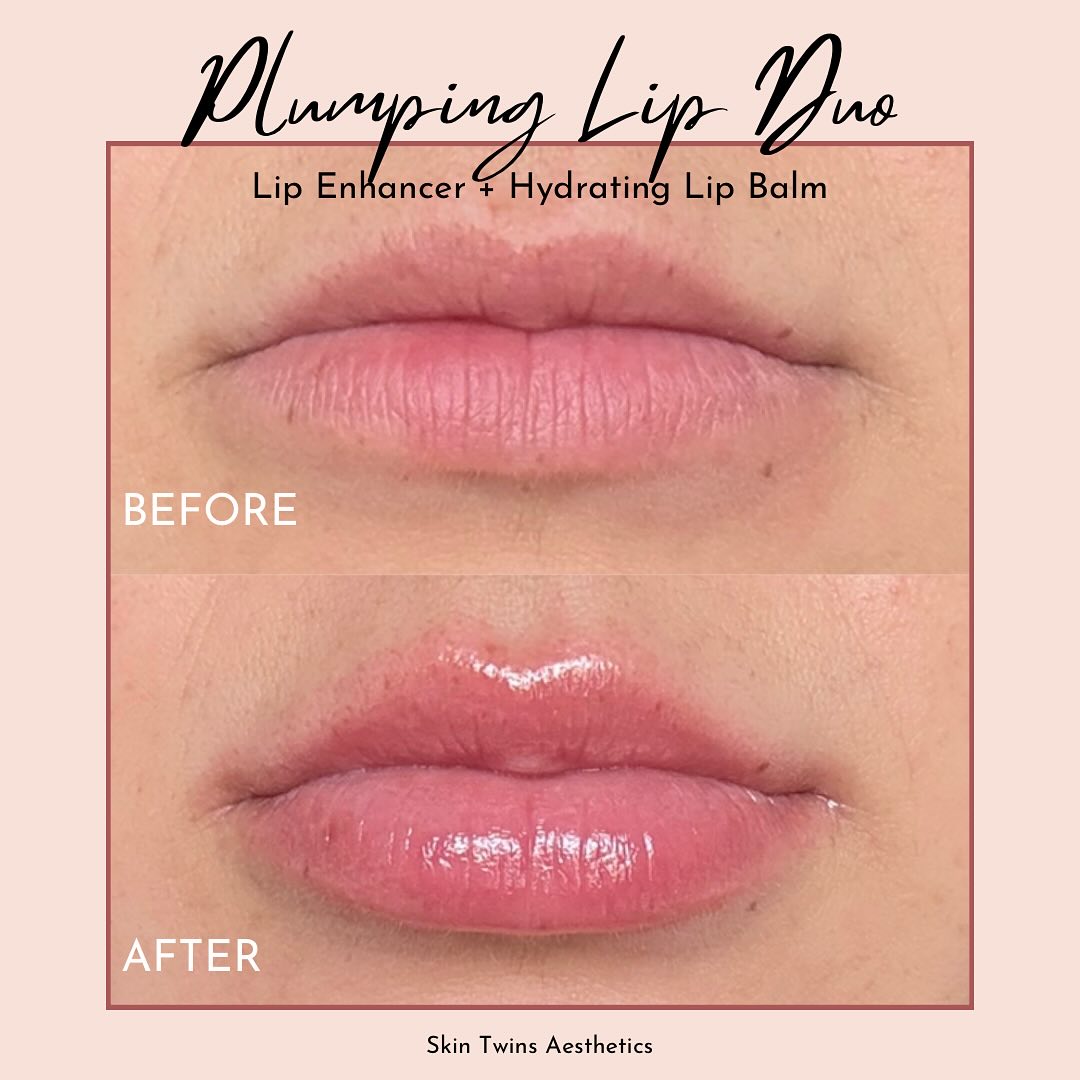 This lip duo before and after is everything!! If you want juicy, hydrated lips you NEED these two products Step 1