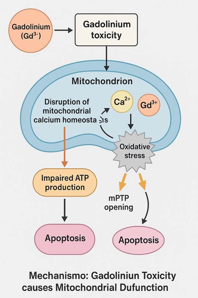Supplements to remove gadolinium after MRI?