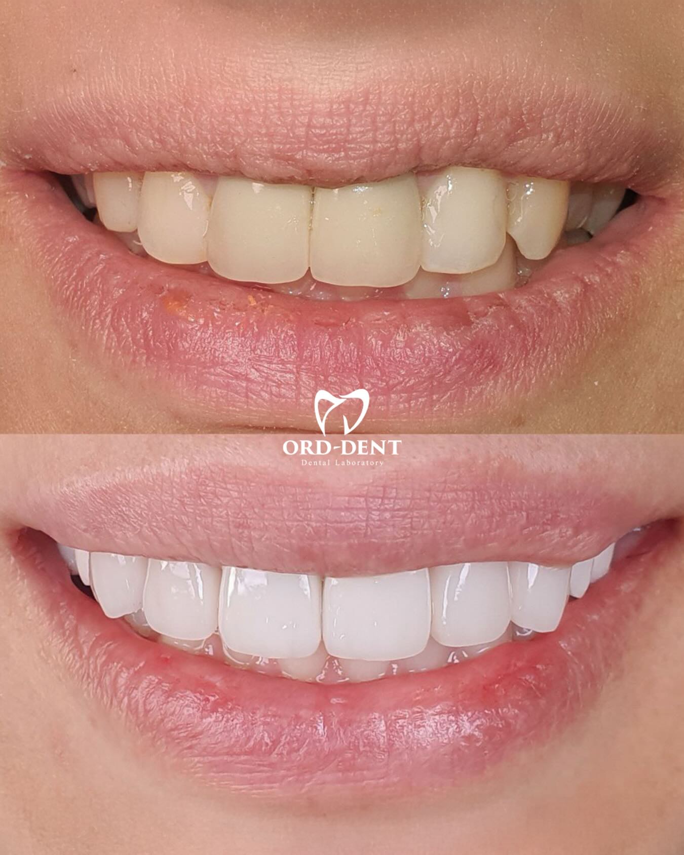 Ord-Dent Dental Laboratory | Yerevan