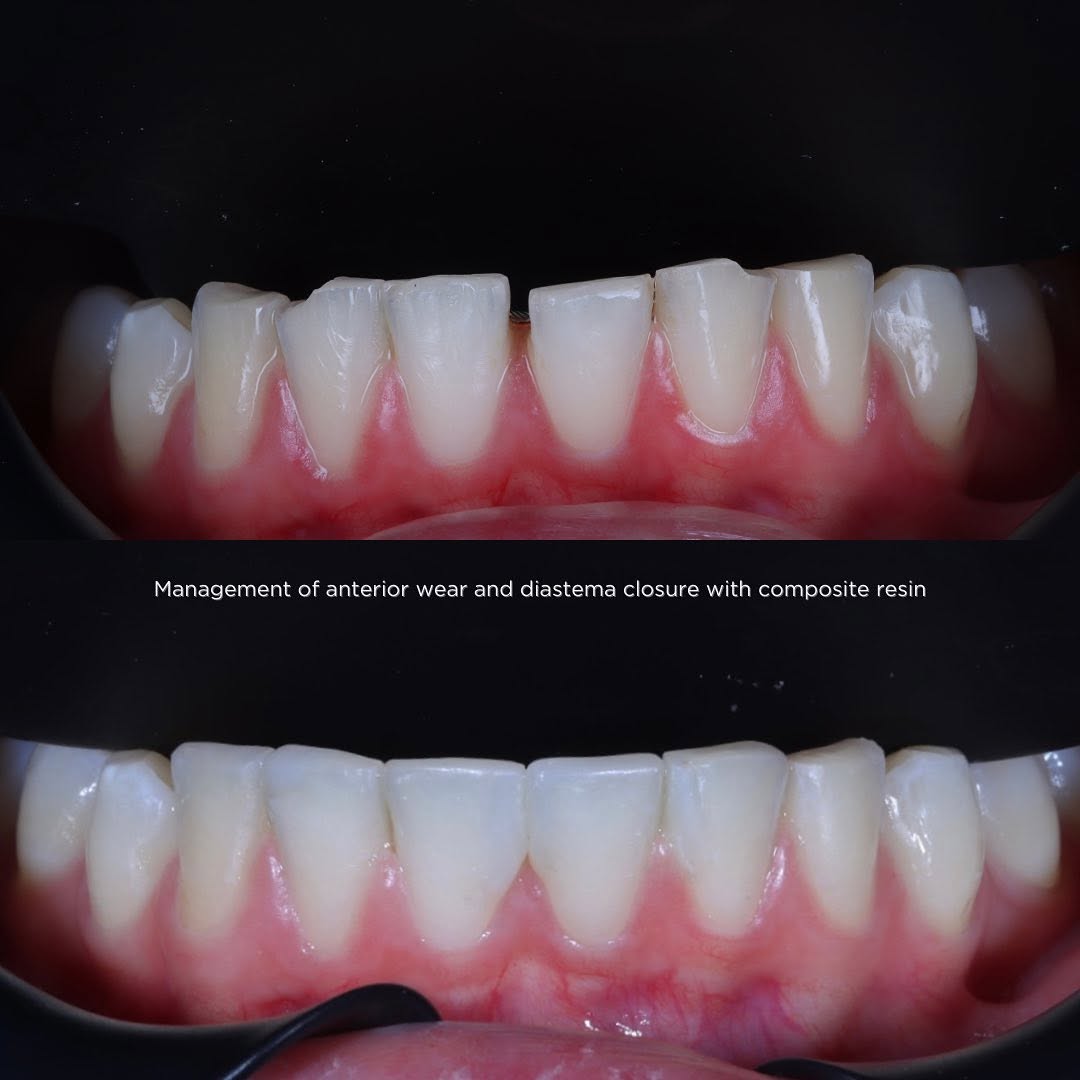RipeGlobal - Some important criteria by @dr.zainrizvi when restoring ...