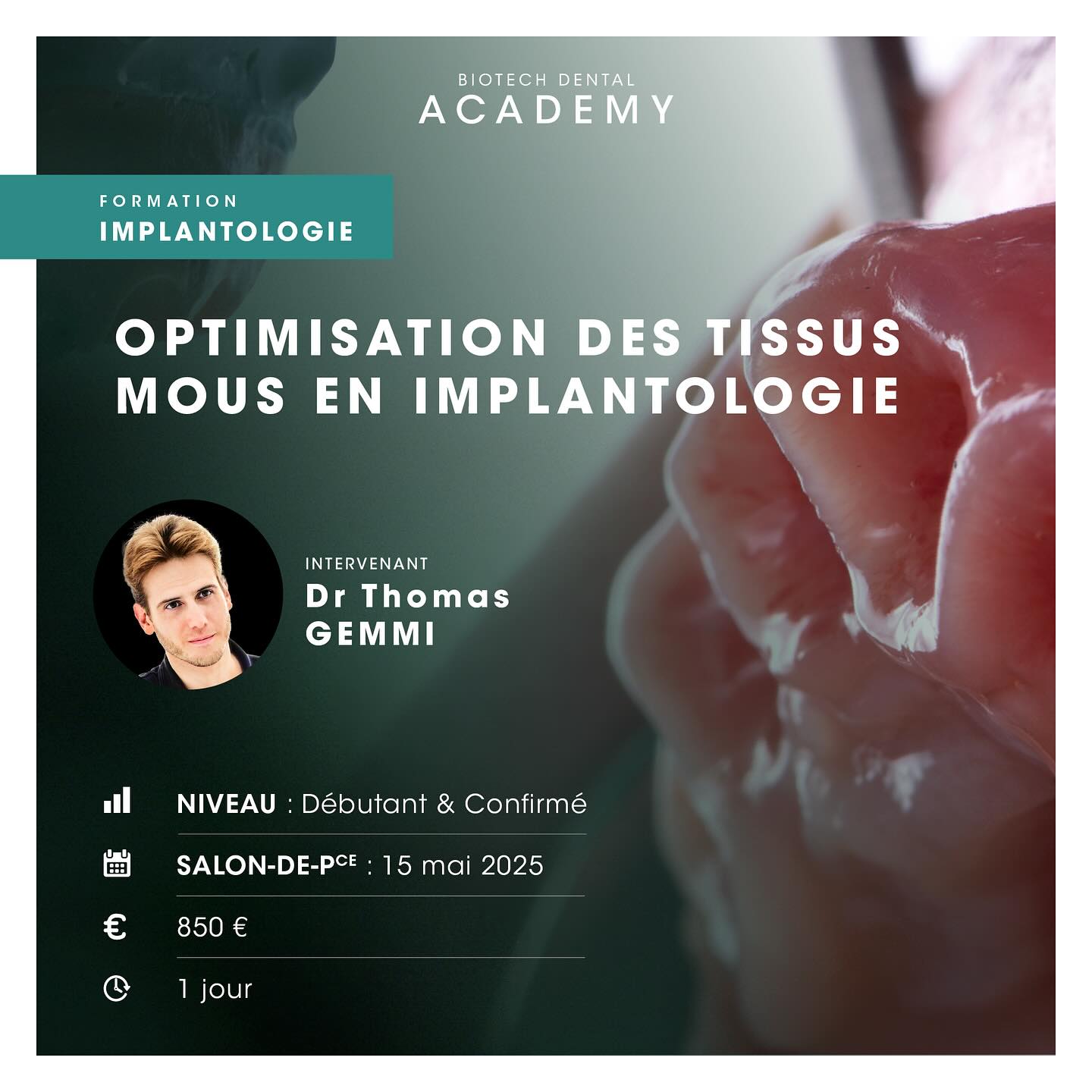 Biotech Dental Academy - [Formation implantologie 🦷] Rejoignez le Dr ...