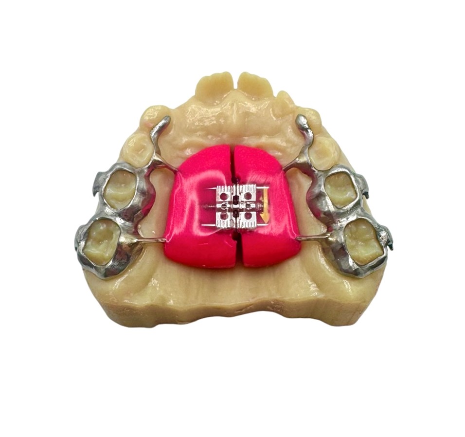 Ohlendorf - 😁 Say hello to our 3D Printed Haas Expander — designed for ...