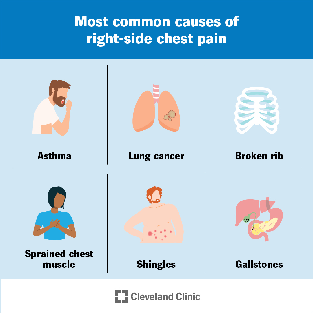 Your guide for left-side chest pain vs.... - Cleveland Clinic | Facebook