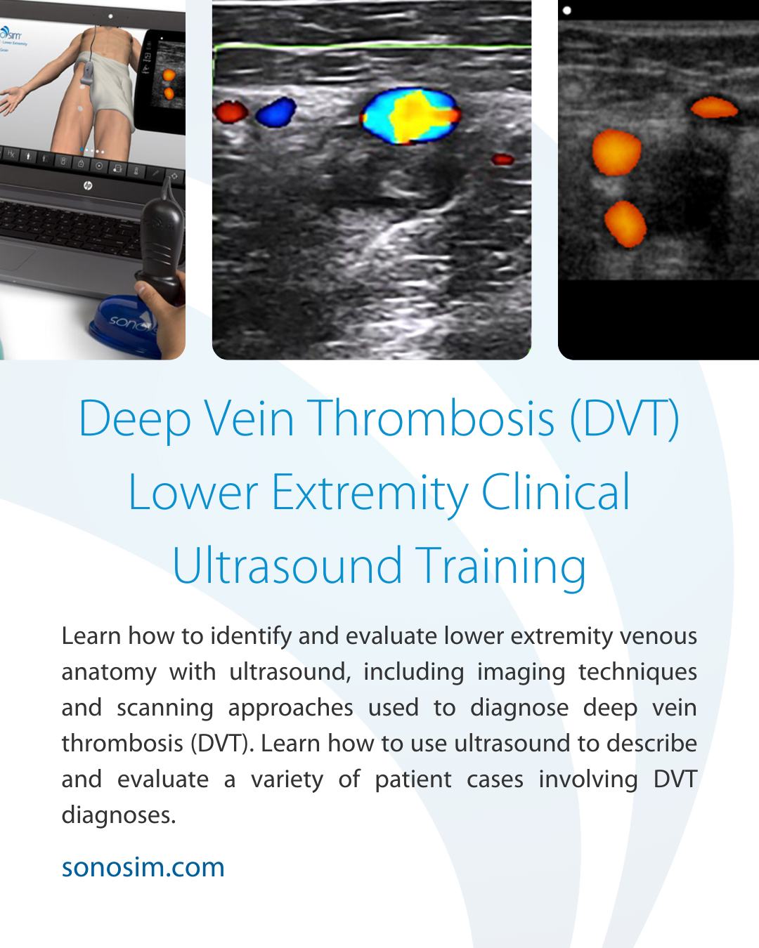 SonoSim - 🔍 SonoSim’s DVT training helps learners master lower ...