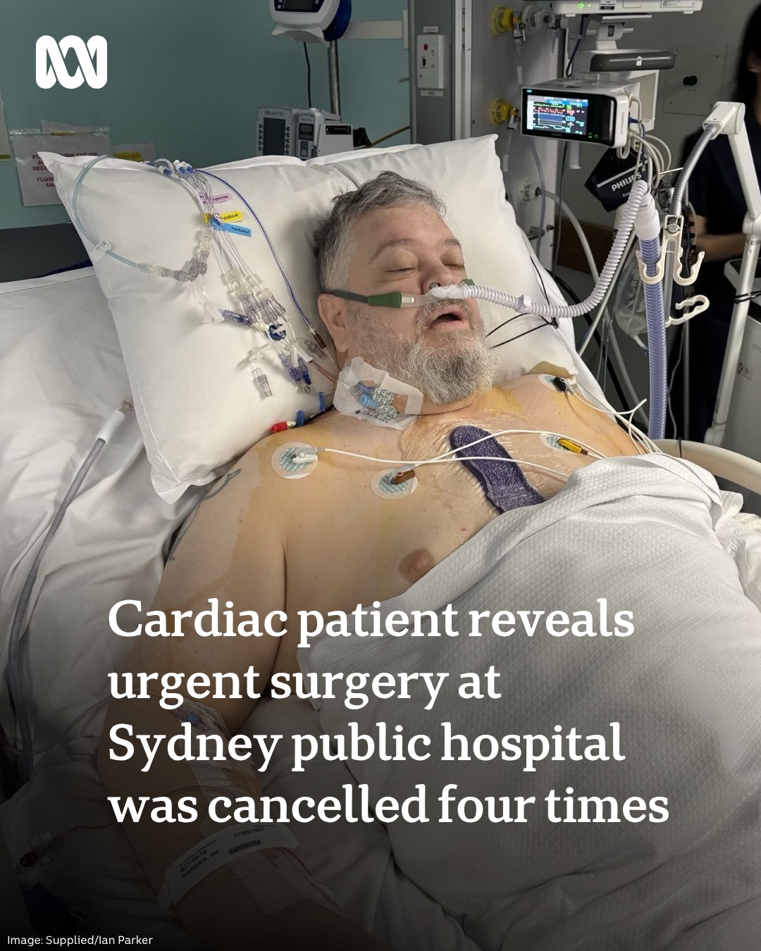 ABC - Ian Parker waited more than three months for urgent heart surgery ...