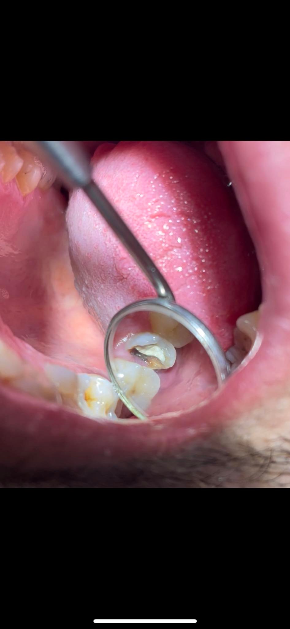La Endodoncia no termina hasta que el... - Dental Nav Smiling | Facebook