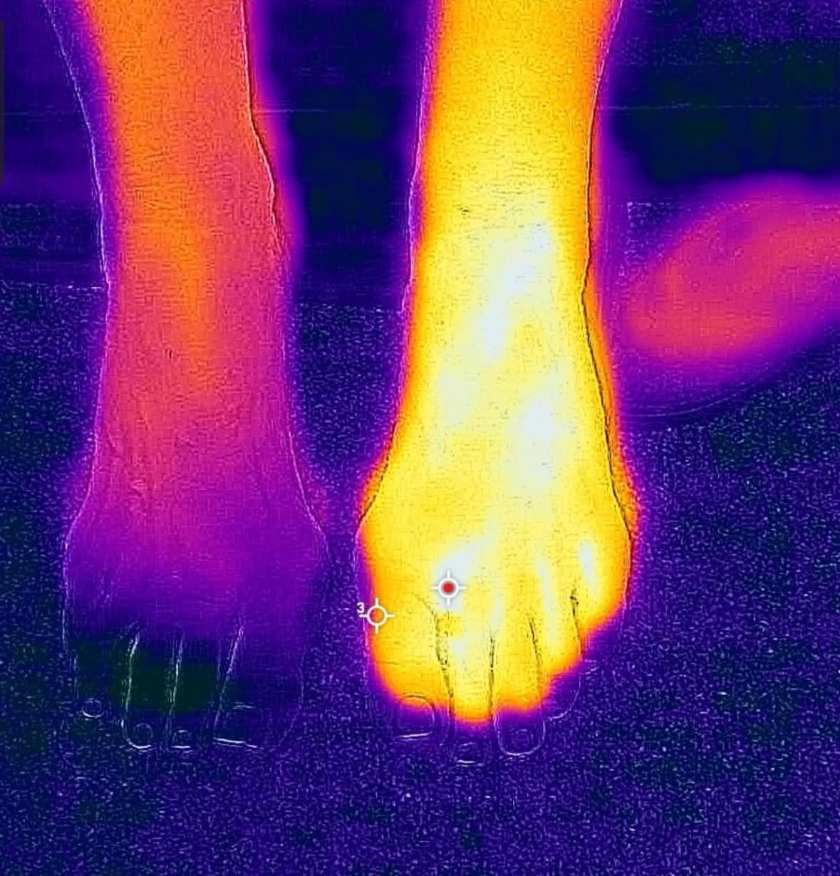 Intermountain - ️Do you have neuropathy?! If you experience neuropathy ...