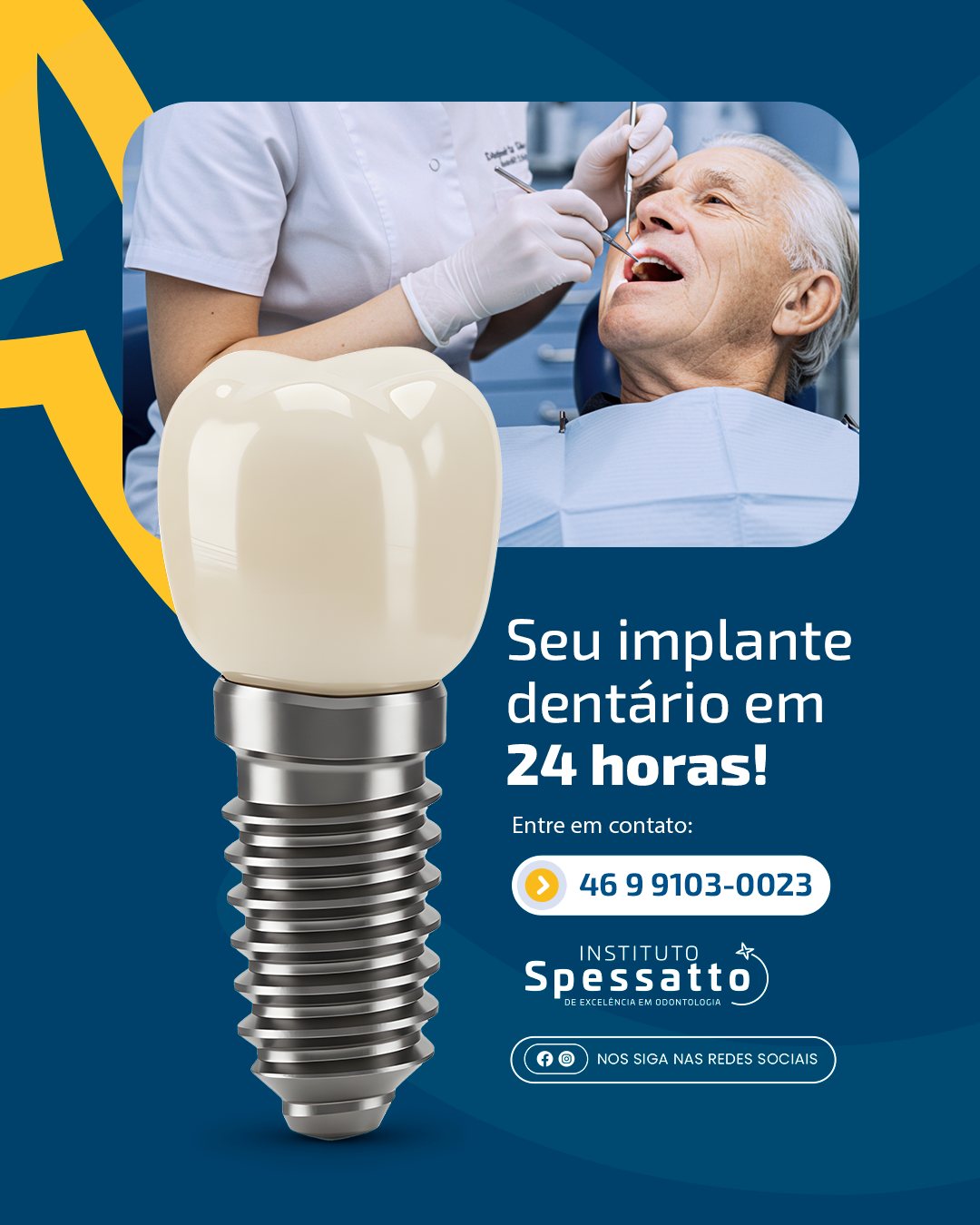 Instituto - Você sabia que é possível realizar um implante dentário e ...