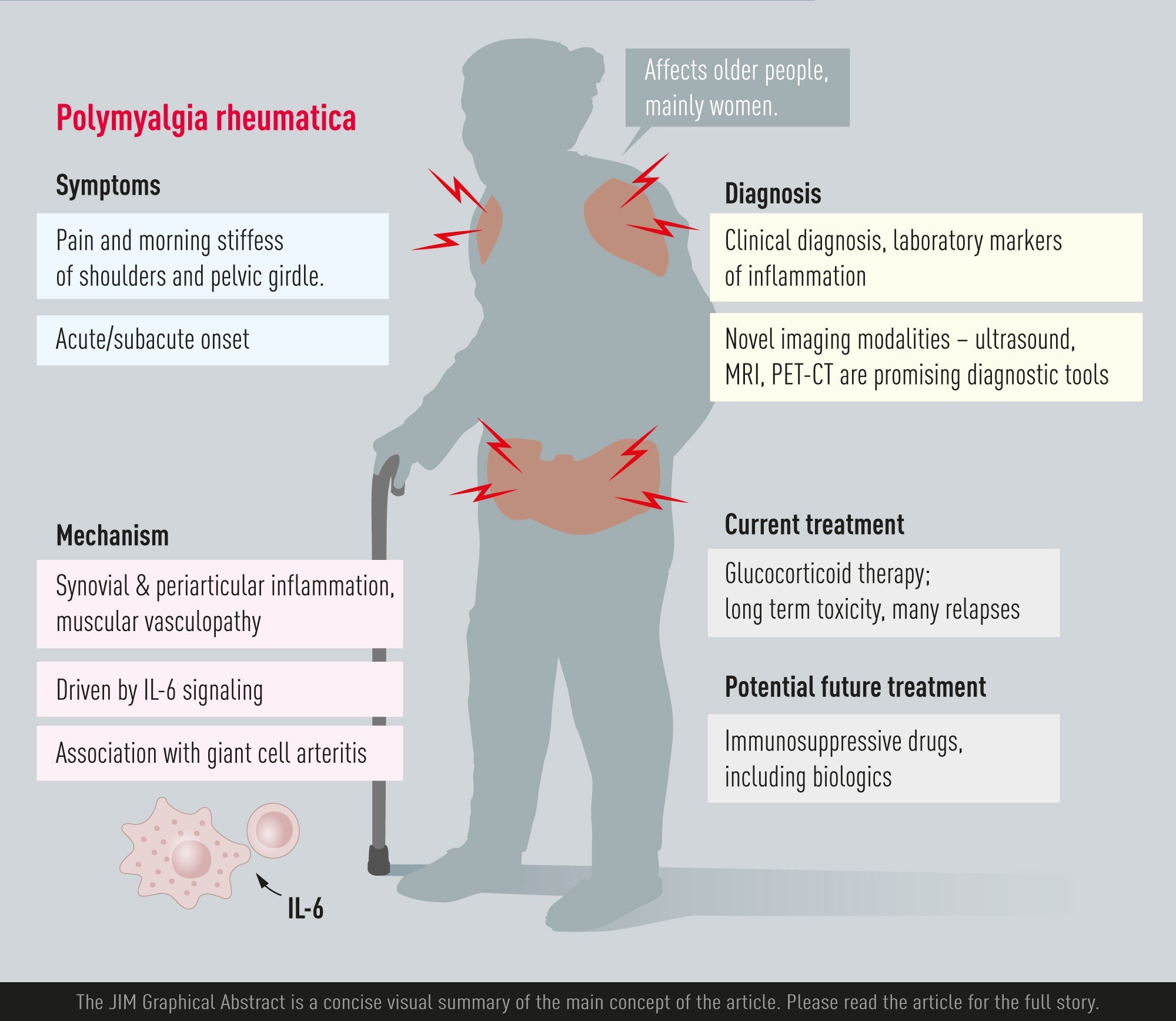 Back - Polymyalgia rheumatica (PMR) is a condition that causes pain ...