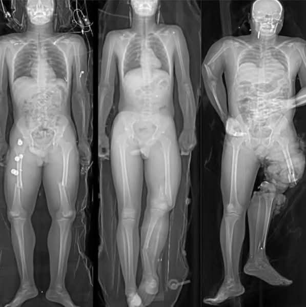 Radiology - Seconds can change lives forever. In a single car crash ...