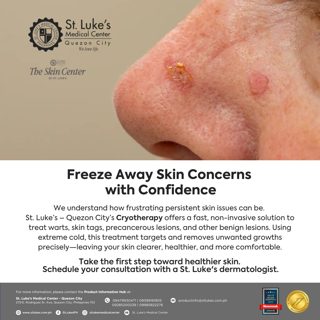 Dealing with persistent skin growths like warts or skin tags can be worrying and can affect your confidence. The Skin Center at St. Luke's