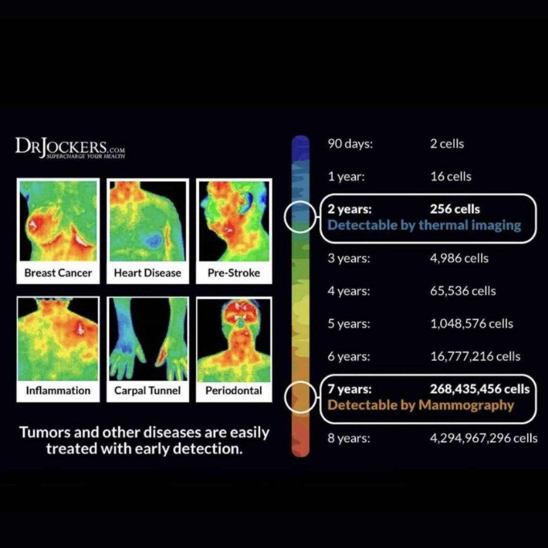 Point - 🌟Thermography is an incredible tool for breast health, but did ...