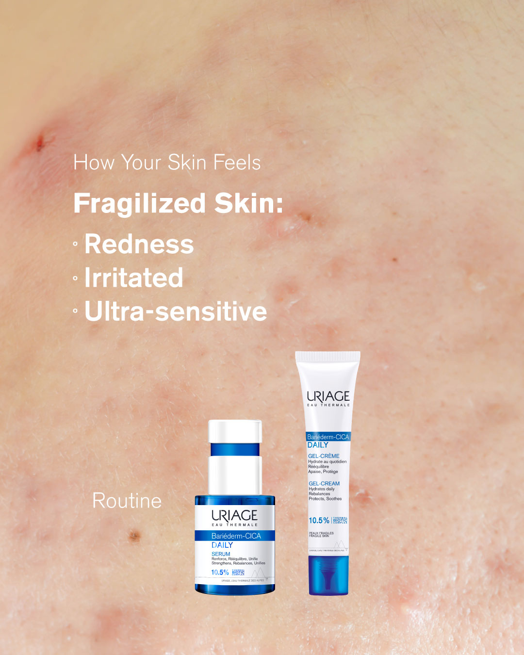 Uriage - Signs you need our Bariederm Cica-Daily Range 💧 It is designed ...