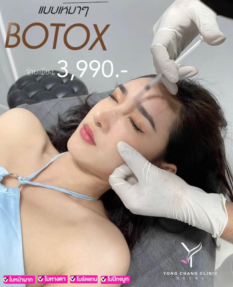 💉โบริ้วรอยทั้งหน้า ด้วย Botox Botolax 🎉 •ริ้วรอย หน้าผาก ตีนกา รัดแกน ...