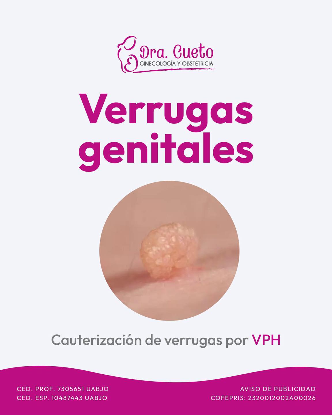Ginecologia - ¿Que son? 😨 Las verrugas genitales son una protuberancia ...