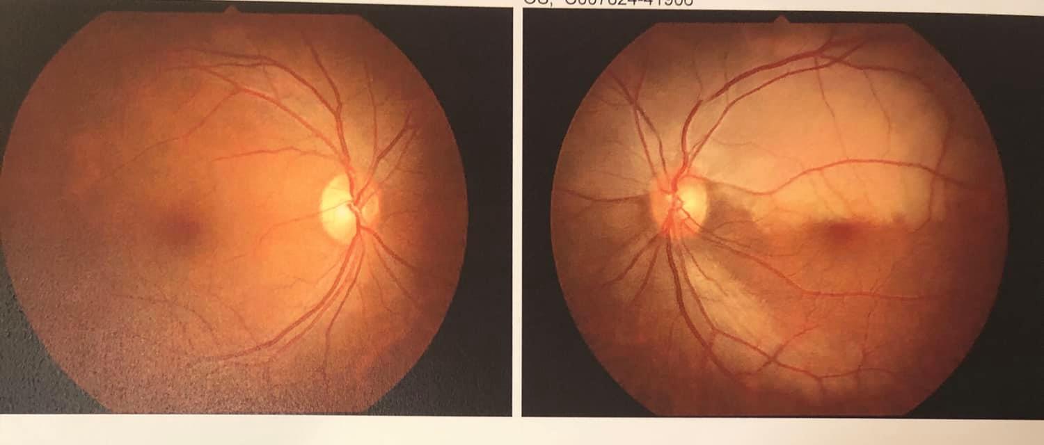 Dr. Sin Pui Yee Helena - Ophthalmologist 冼佩儀眼科專科醫生