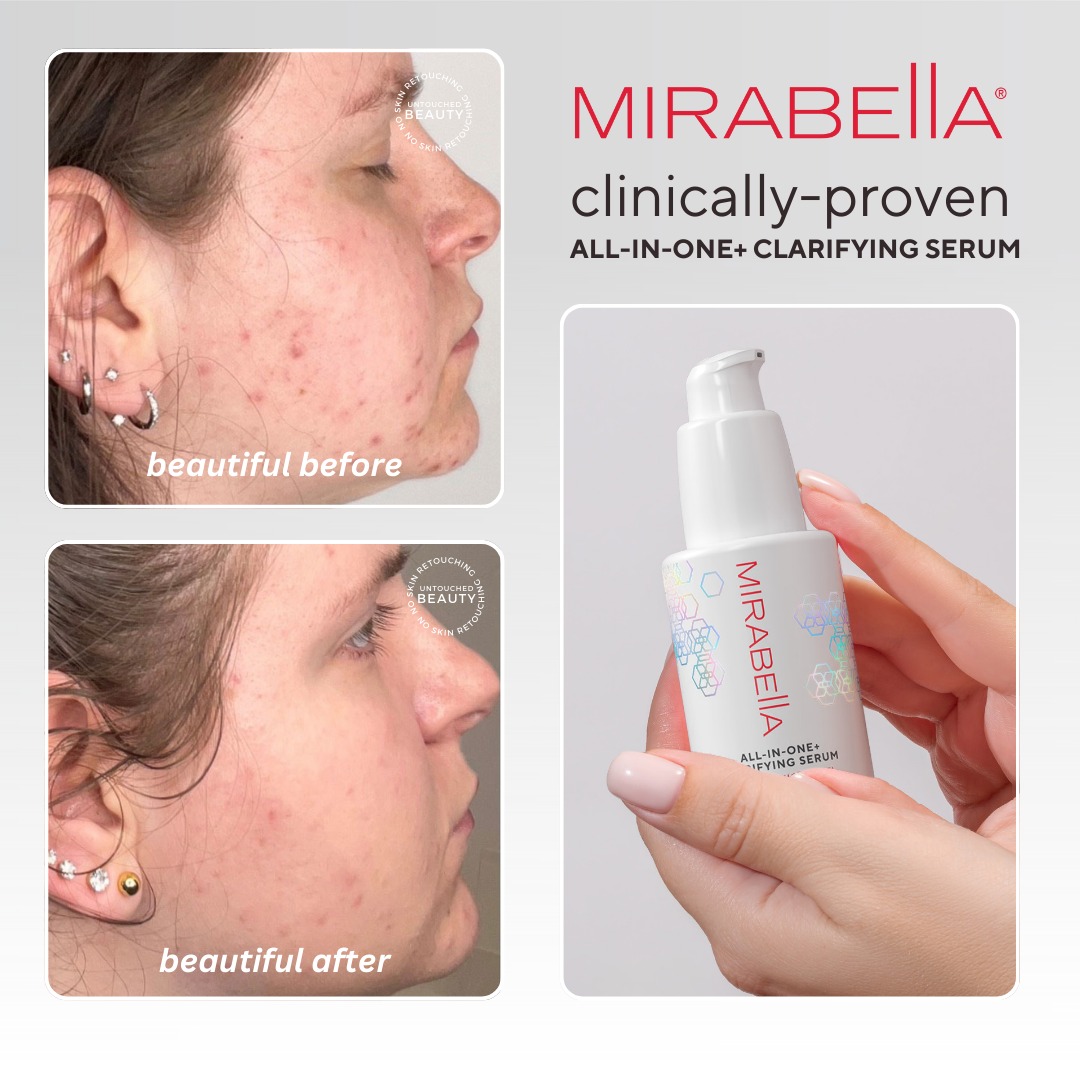 Meet your skin’s fall reset... - Mirabella Beauty | Facebook
