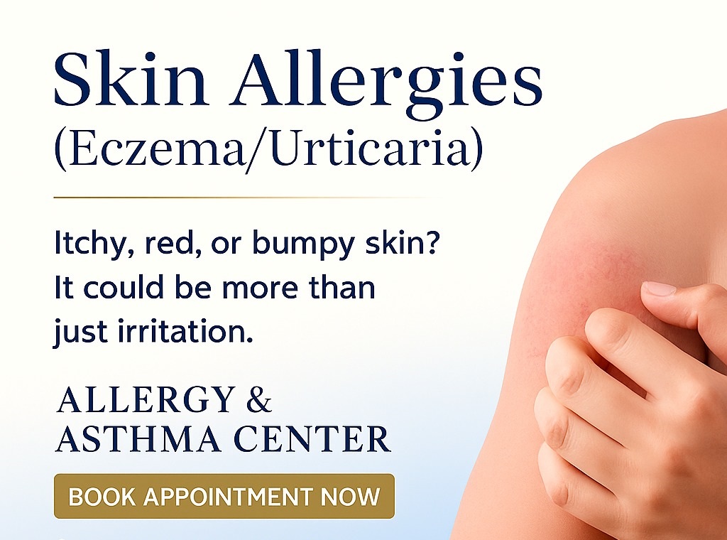 Islamabad - 🌸 Skin Allergies (Eczema / Urticaria) 🌸 Itchy, red, or ...