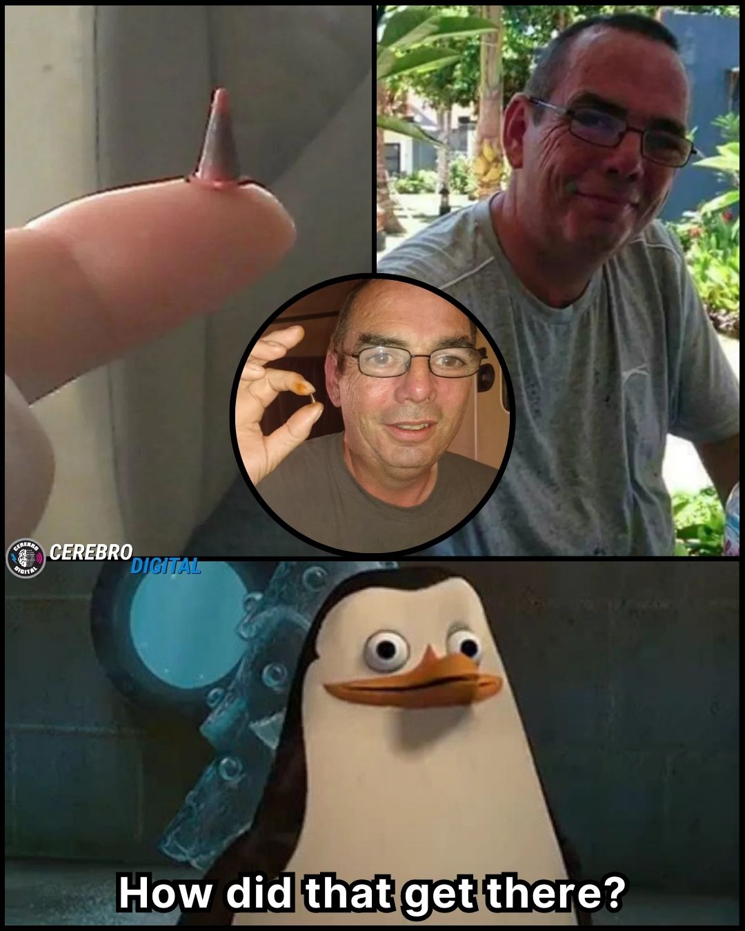 Digital - A 47-year-old man went to a hospital in the United Kingdom ...