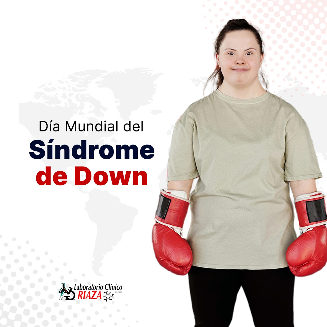 Laboratorio - 21 de marzo: Día Mundial del Síndrome de Down Hoy ...