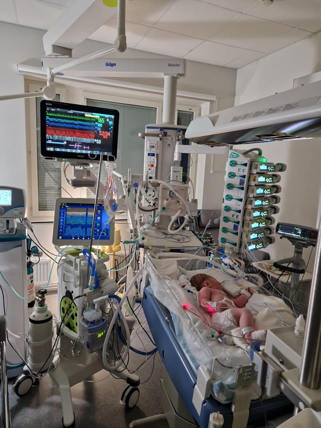 Neonatal-IVA US Linköping | Linköping