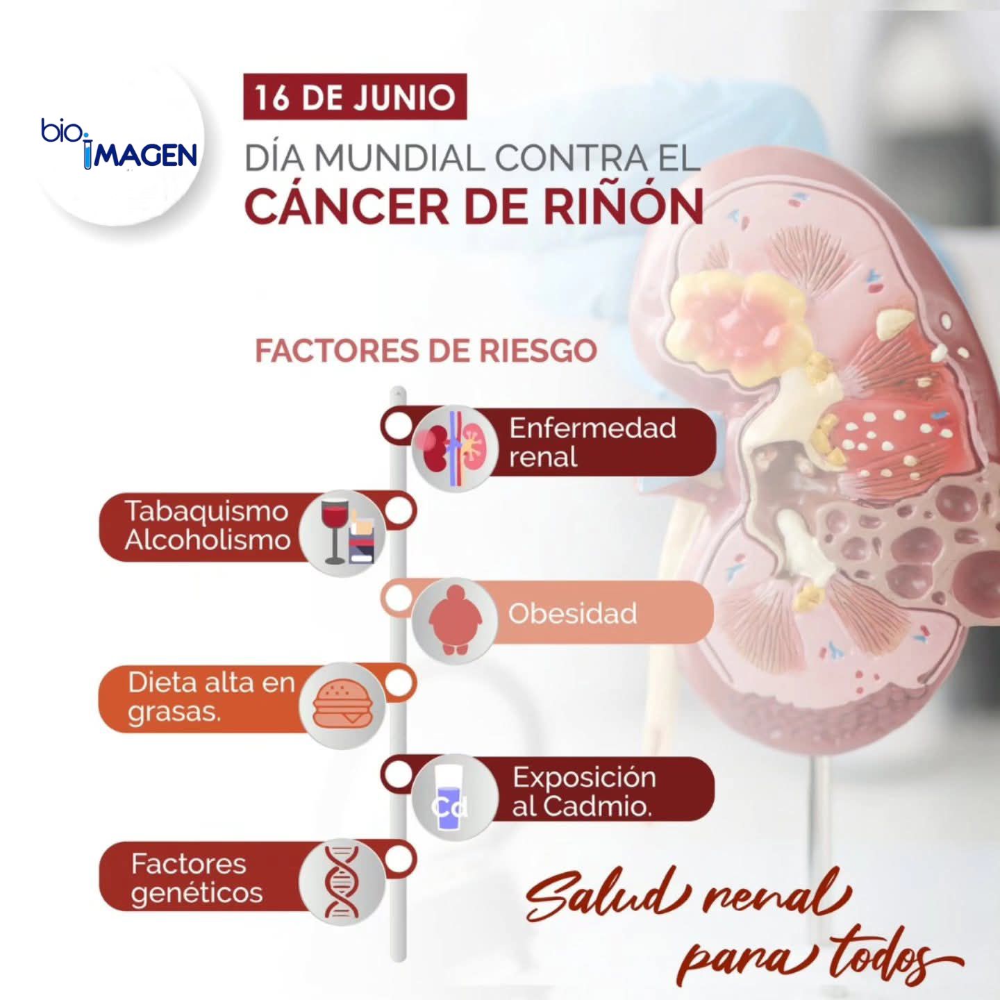 Laboratorio - 🗓️ 16 de junio – Día Mundial contra el Cáncer de Riñón ...