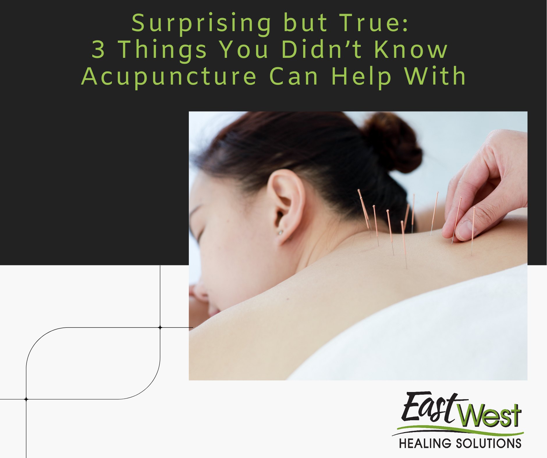 East - Surprising but True: 3 Things You Didn’t Know Acupuncture Can ...