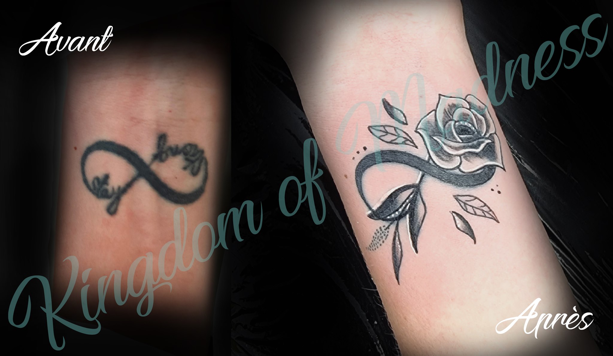 Recouvrement Tatouage Avant Bras Femme