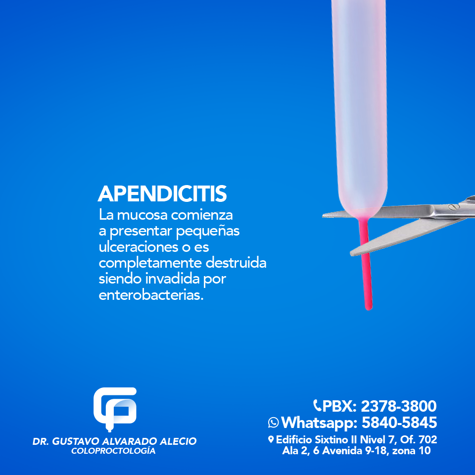 ¿Conoces qué es la... - Dr. Gustavo Alvarado Alecio