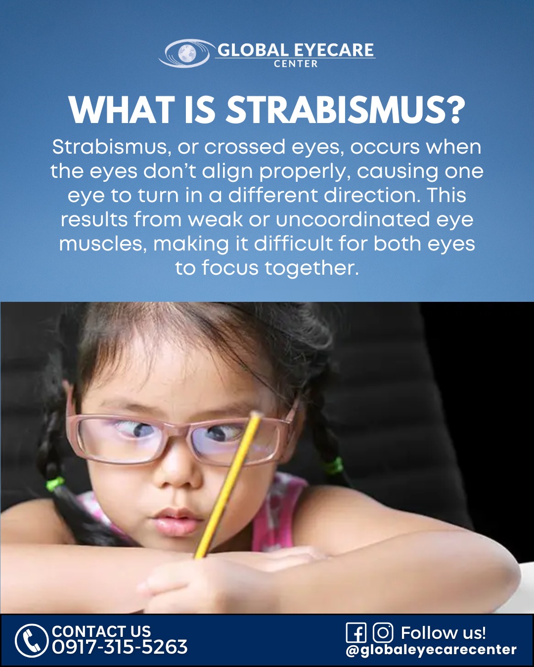 Global - What is Strabismus? 👀 Strabismus, or crossed eyes, is a ...
