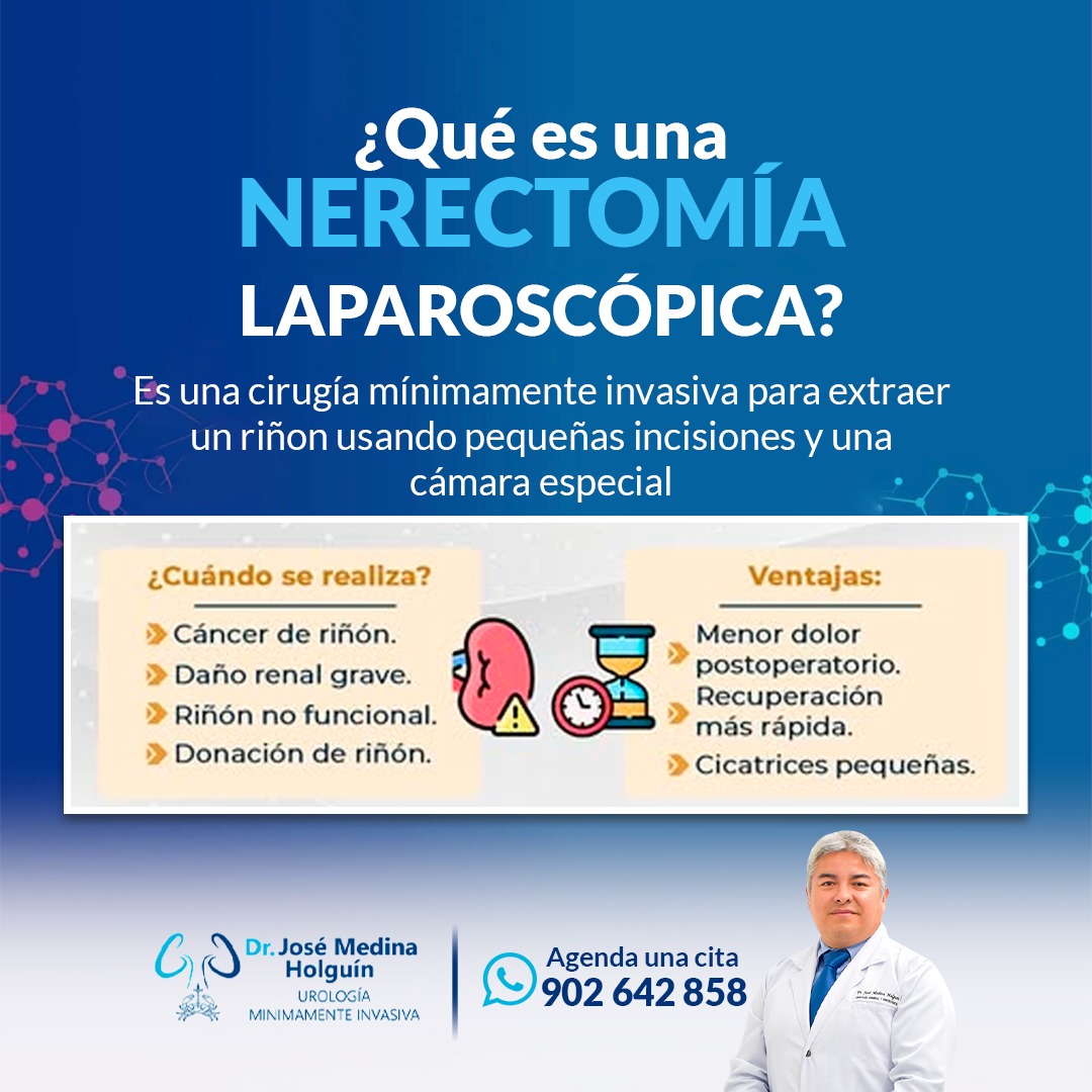 Urólogo - 👨‍⚕️🔍 ¿Sabías qué es una Nefrectomía Laparoscópica? Es una ...