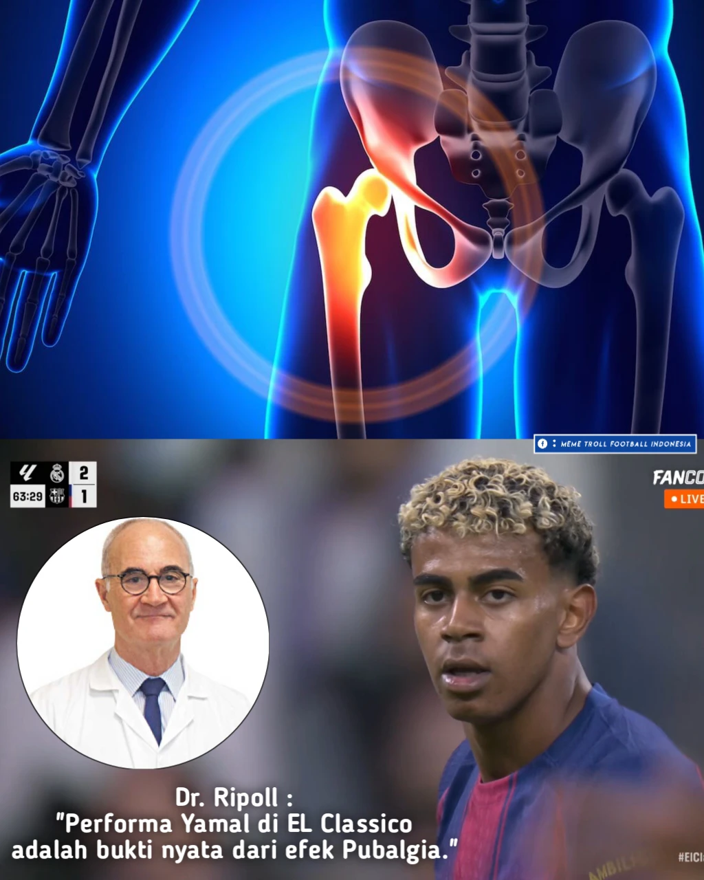Meme - Menurut dokter spesialis traumatologi olahraga ternama, yaitu Dr ...
